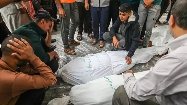 صحة غزة: ارتفاع ضحايا المجاعة وسوء التغذية إلى 151 شهيدا من بينهم 89 طفلا