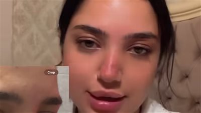 كنزي مدبولي تفتح النار على الطبيبة التي شوهتها: طلعت خبرة وبتشوه كل الناس