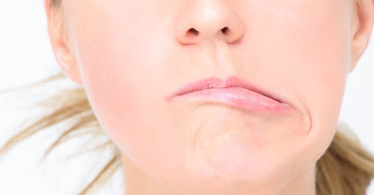 أعراض العصب السابع