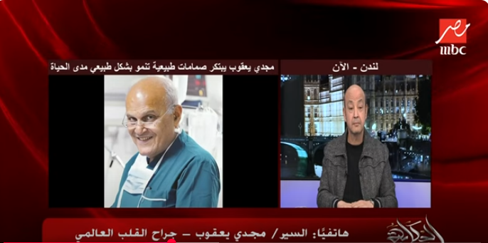 الدكتور مجدي يعقوب