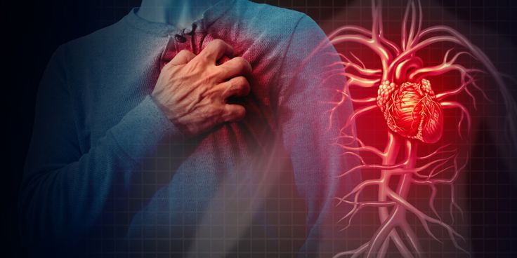اعتلال عضلة البطين الأيمن