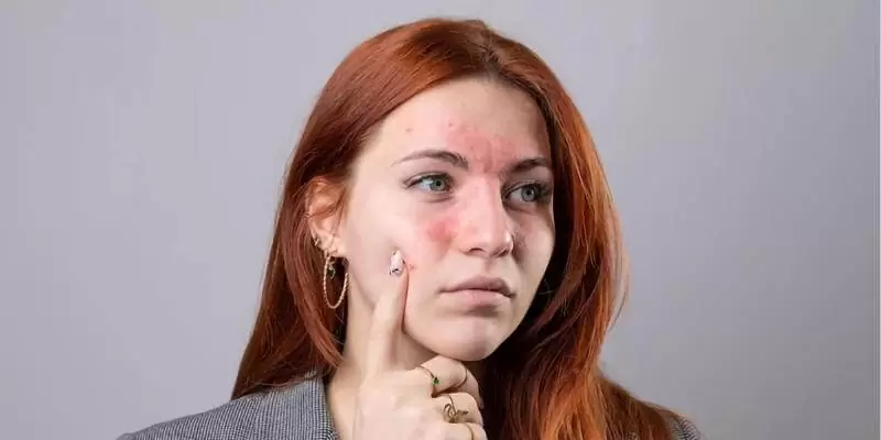 أضرار المنتجات المضروبة