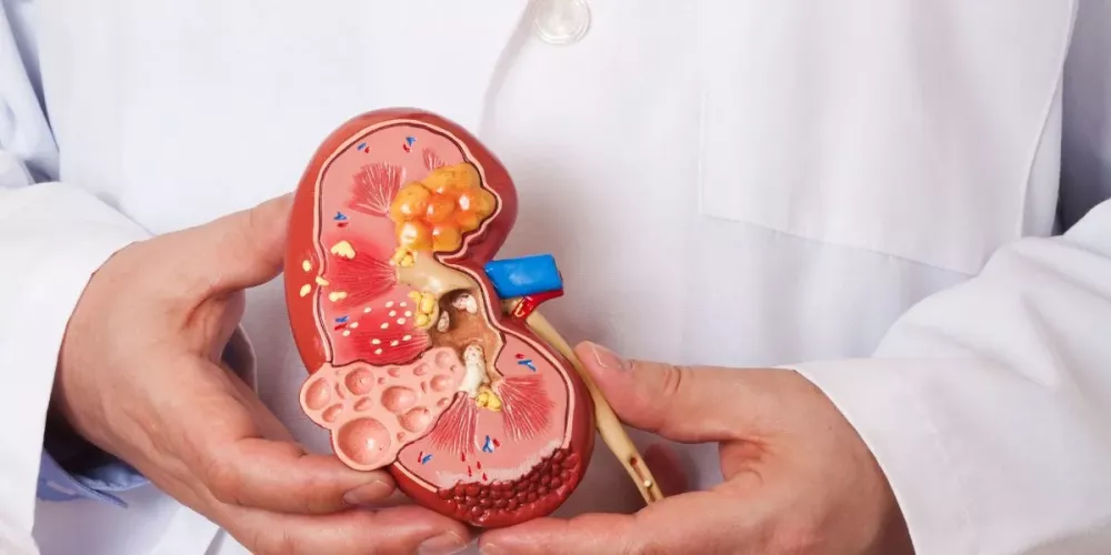 علامات تحذيرية تكشف إصابتك بمشكلة في الكلى