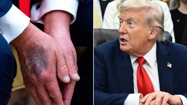 <strong>الرئيس الأمريكي دونالد ترامب</strong>