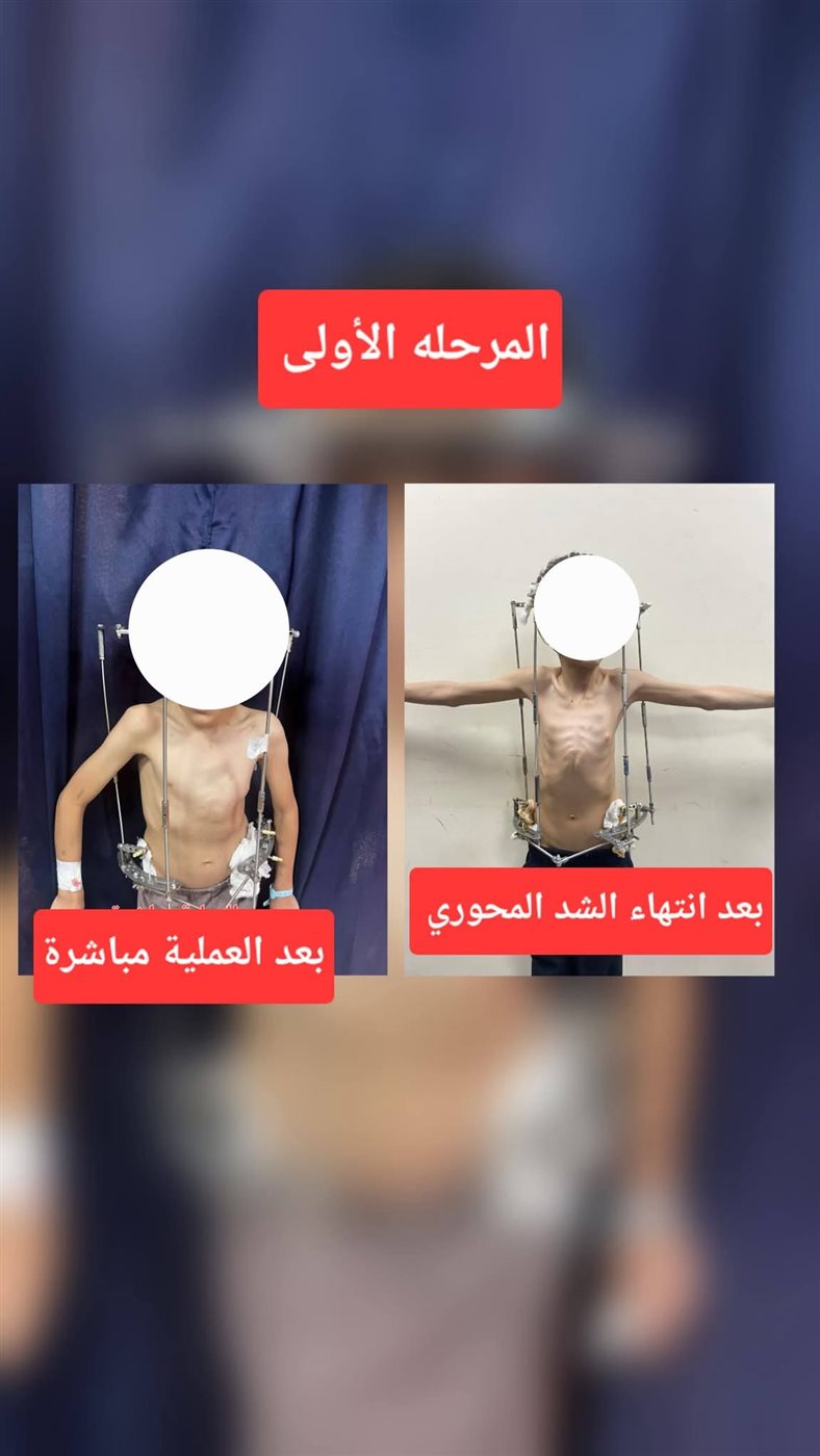 نجاح العملية الجراحية&nbsp;