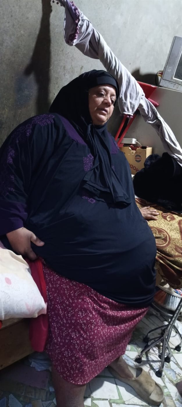 محدش راضي يعالجني: سيدة بالفيوم تستغيث بالمسئولين: اتعرضت لخطأ طبي من 17 سنة ونفسي أقوم من السرير