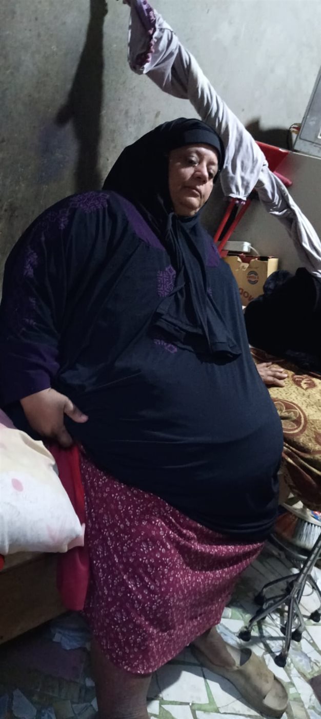 محدش راضي يعالجني: سيدة بالفيوم تستغيث بالمسئولين: اتعرضت لخطأ طبي من 17 سنة ونفسي أقوم من السرير