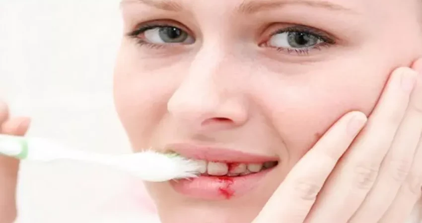 أسباب الإصابة بنزيف اللثة&nbsp;