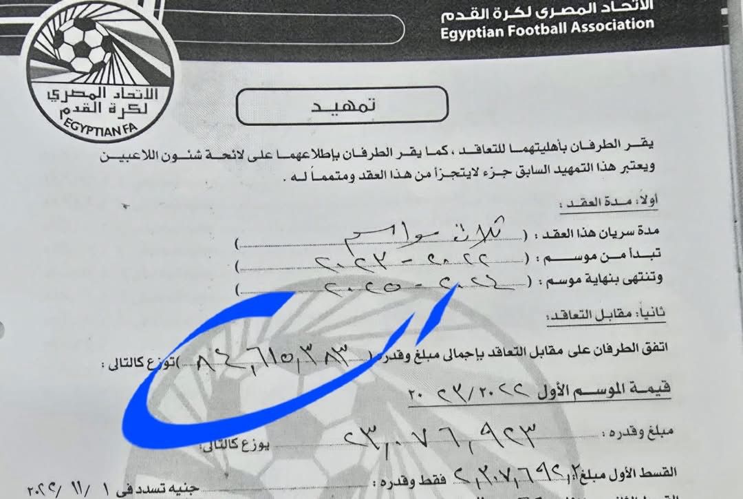 عقد زيزو&nbsp;