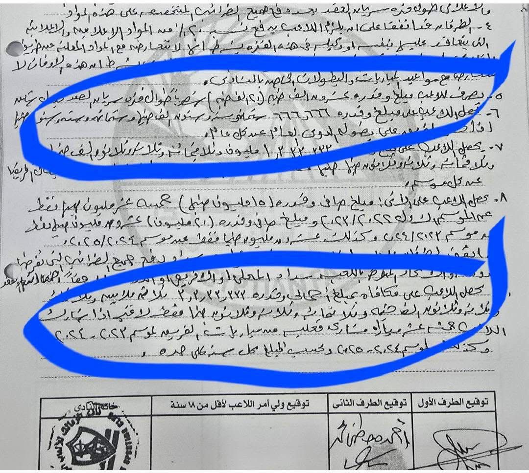 عقد زيزو&nbsp;