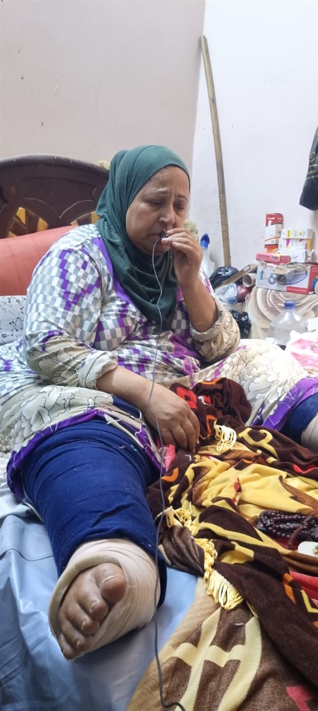 «كل حاجة بعملها على السرير».. مدام أكرام بالفيوم تستغيث بعد 8 سنوات مع داء الفيل : نفسي دكتور يتبنى حالتي