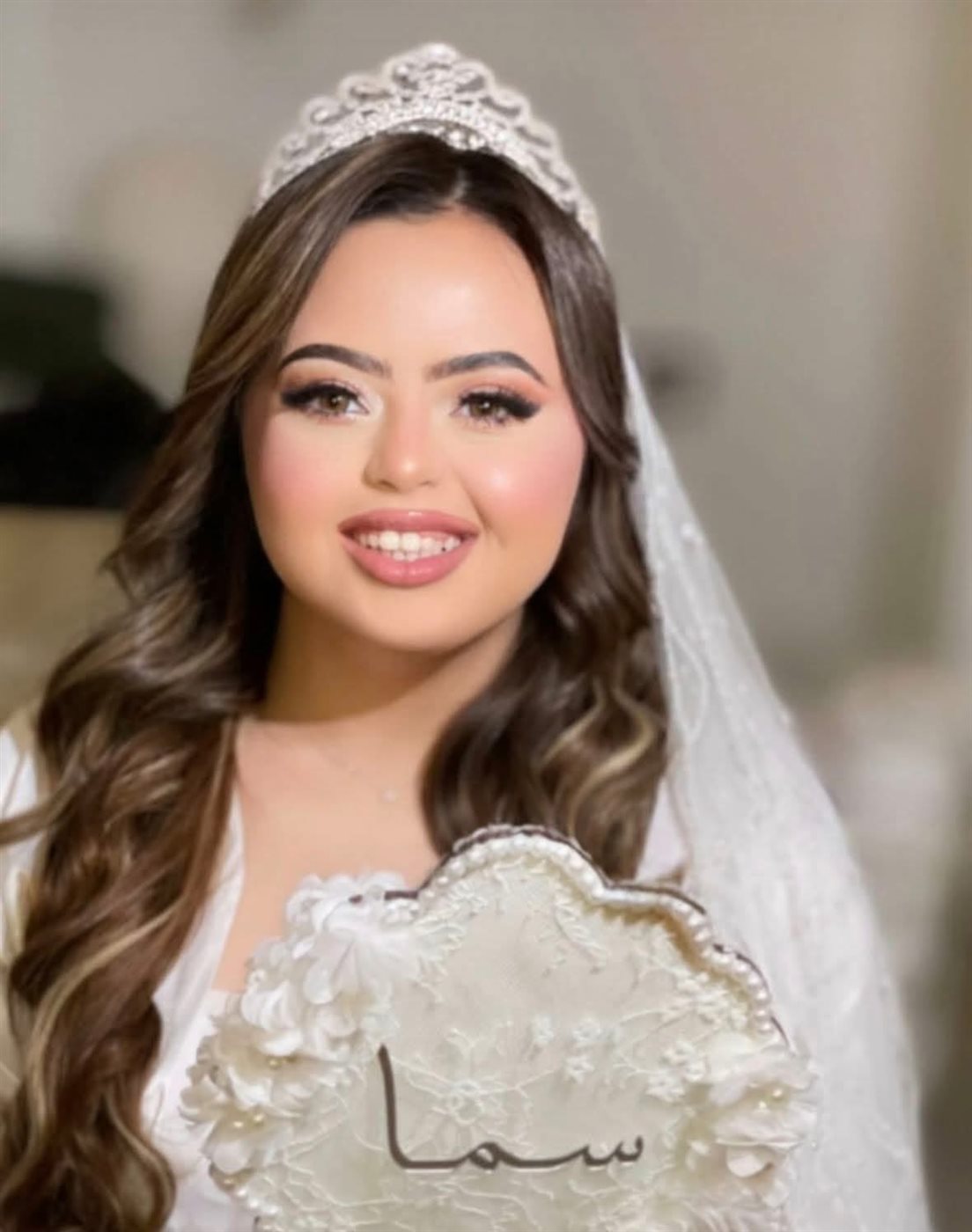 زواج سما رامي يفتح التساؤل.. هل يستطيع ذوو متلازمة داون خوض تجربة الزواج؟|خاص