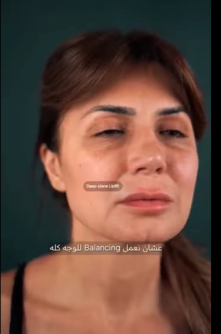 نجلاء بدر قبل خضوعها لعملية تجميل لشد الوجه