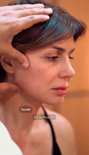 نجلاء بدر قبل خضوعها لعملية تجميل لشد الوجه