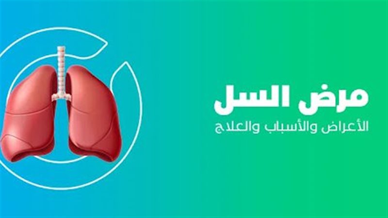 مرض السل