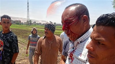أول تعليق من زراعة سوهاج حول إصابة مسؤول حماية الأراضي أثناء إزالة بناء مخالف