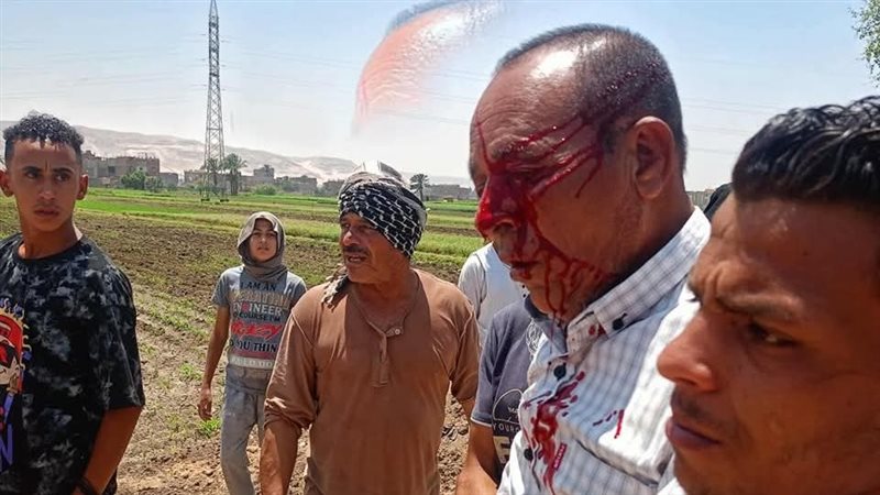 الموظف المصاب بسوهاج