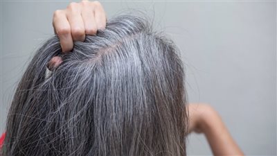 تحذيرات طبية من خطورة نزع الشعر الأبيض.. تفاصيل         