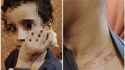 ضحية جديدة لخراب البيوت.. من ينقذ «فاطمة» من عذاب زوج الأم؟