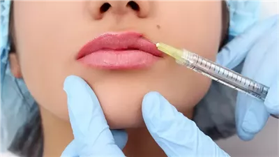 تحذيرات بريطانية: عمليات تجميل تتم فى المراحيض وحقن خطيرة تُباع أون لاين 
