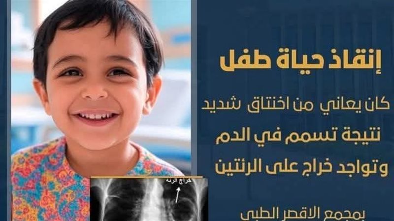 الاقصر