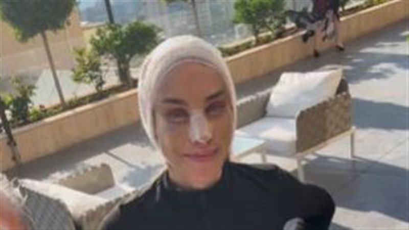 صورة للمريضة التي