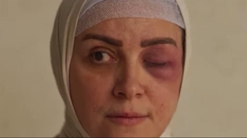 ظلم المصطبة