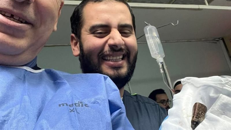 استخراج 3 حجارة قلم