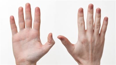 علامات تظهر على اليدين تكشف مشكلات صحية خطيرة.. اعرفها الآن 