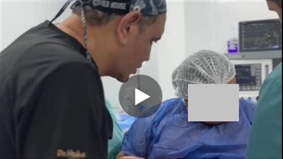 مخاطر عملية تكميم المعدة للأطفال..جدل واسع بعد انتشار فيديو مؤثر