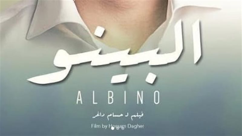 ألبينو 