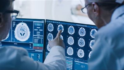 أطباء في الصين يزيلون دودة شريطية طولها 18 سم من دماغ مريض