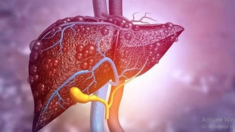 علاج أمراض الكبد
