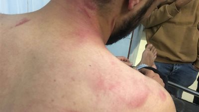 إصابة شخصين في اعتداء على فريق تصوير زفاف بدمياط الجديدة