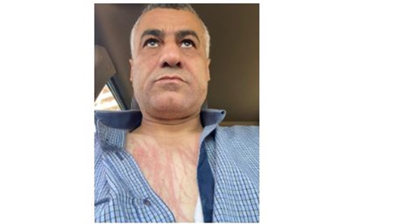 المجني عليه