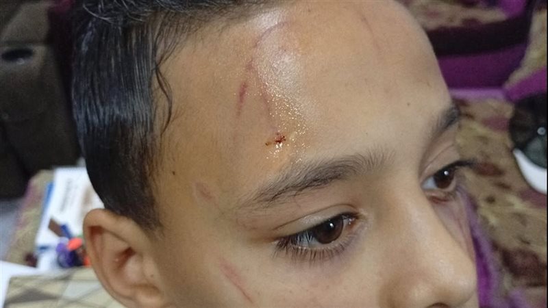 الطالب المصاب