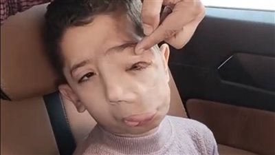 «ابني شاف كتير».. أب يناشد الرئيس السيسي لإنقاذ طفله من ورم نادر