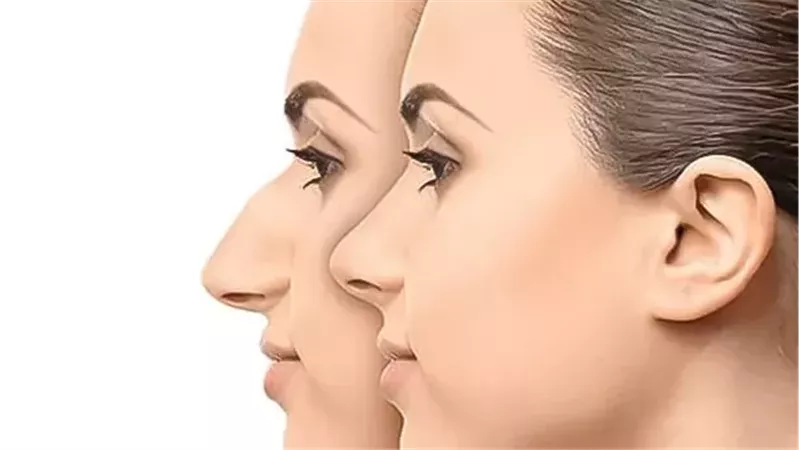 الانف 
