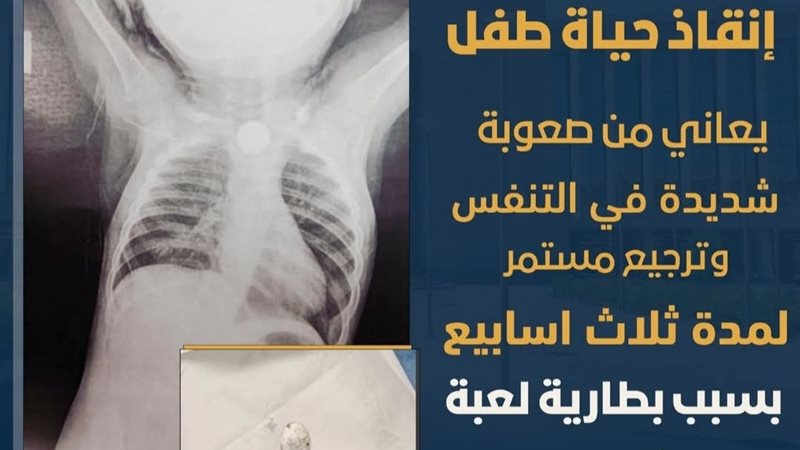 صوره الاشعه والبطارية