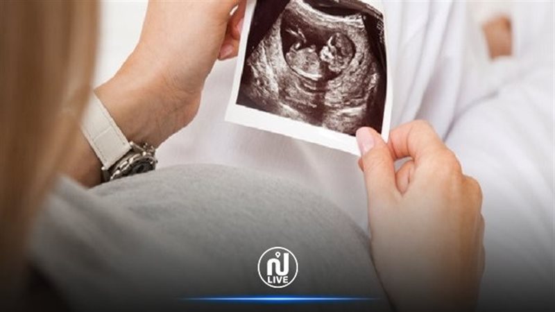 إخراج الزكاة عن الجنين