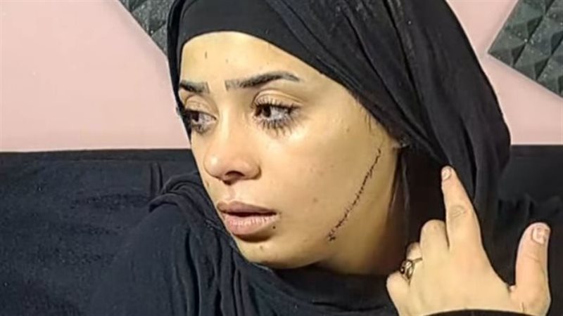 الضحية 