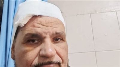صدمته سيارة مجهولة.. إصابة مرشح بالمنوفية خلال سيره بالدائرة