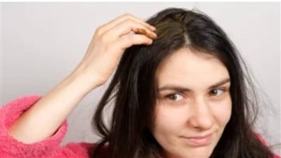 القهوة وغيرها.. أفضل وصفات طبيعية لعلاج قشرة الرأس الدهنية