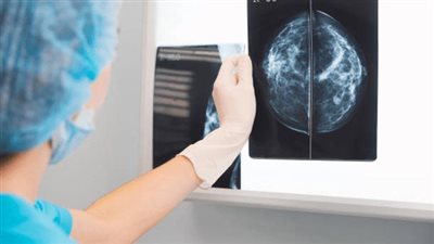 تقنيات ذكاء اصطناعي تتنبأ بالإصابة بسرطان الثدى قبل ظهوره بخمس سنوات