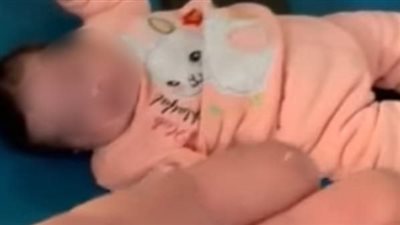 بلعت جزء من ولاعة.. العناية الإلهية تنقذ رضيعة من الموت اختناقا