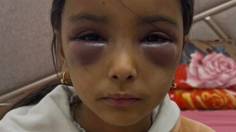الطفلة