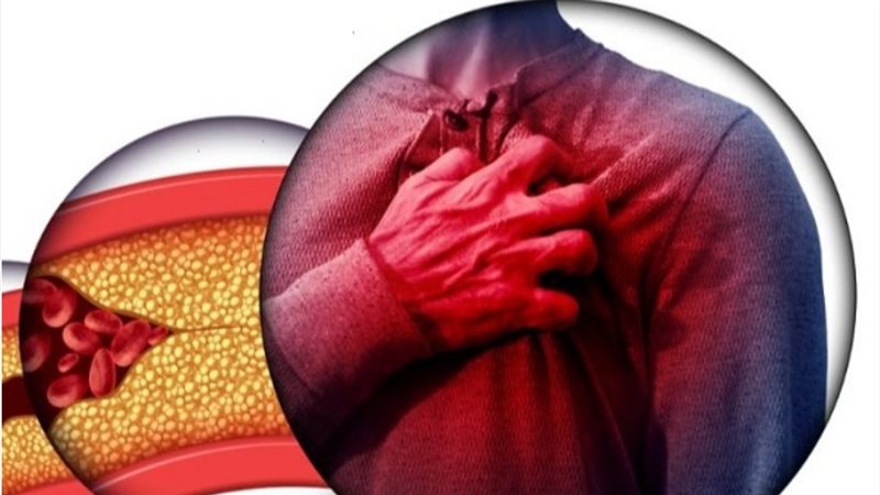 5 أسباب لتصلب الشرايين