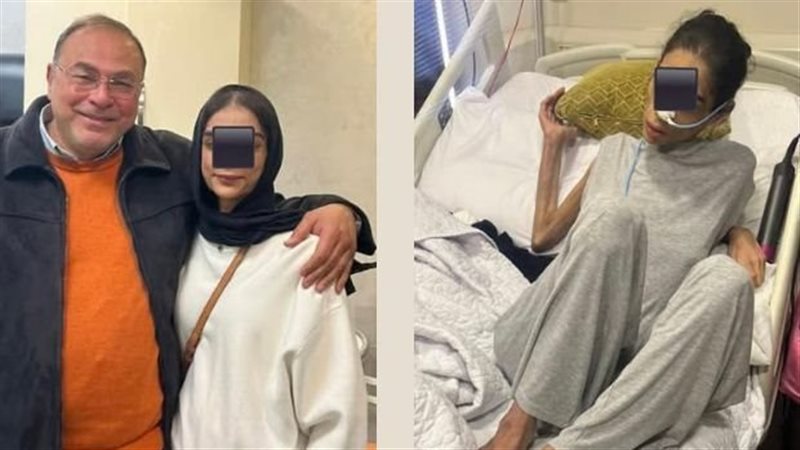 طبيب مصري ينجح في