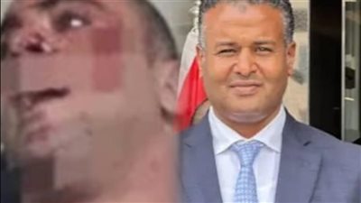حبس مدير «جيم الديزل» لاتهامه بالتعدي على رجل أعمال بالشيخ زايد
