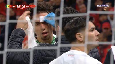 المغرب والسنغال.. إصابة دموية لنيل العيناوي بنهائي كأس الأمم الأفريقية 2025